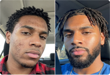 Before & After